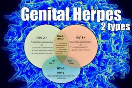 genital-herpes-270x180-4